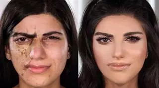 Wykonuje makijaż kobietom ze zdeformowanymi twarzami. Jego metamorfozy to arcydzieła