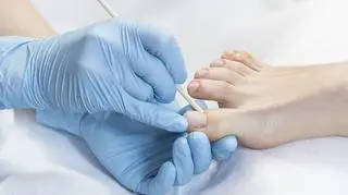 Żółte paznokcie u nóg – przyczyny, preparaty, domowe metody