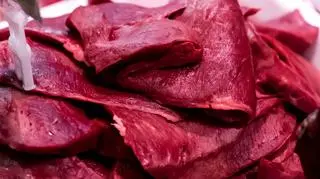 Zmarł w wyniku alergii na czerwone mięso. Czym jest zespół alfa-gal? 