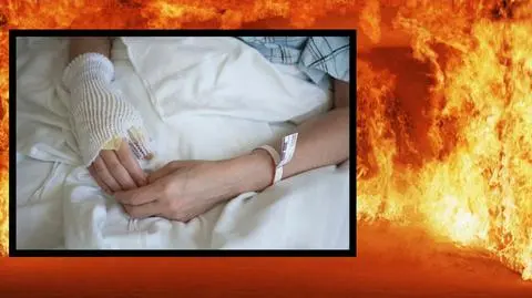 Chechło. Kobieta poparzona podczas imprezy
