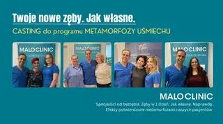 Marzysz o pięknym uśmiechu? Prześlij nam swoje zgłoszenie i weź udział w castingu 