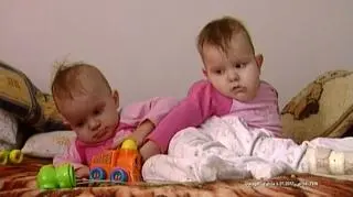 Uratował je książę. Niezwykła historia bliźniaczek syjamskich z Janikowa