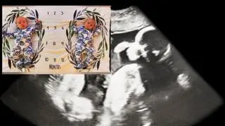 "Zaszłam w ciążę, gdy byłam już w ciąży". Wyjątkowa historia 30-letniej mamy  