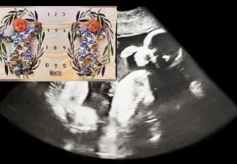 "Zaszłam w ciążę, gdy byłam już w ciąży". Wyjątkowa historia 30-letniej mamy  