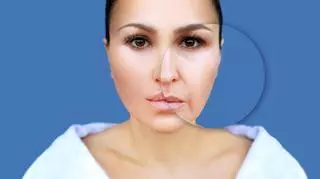 Kobieta ze zmarszczkami wokół ust i nosa
