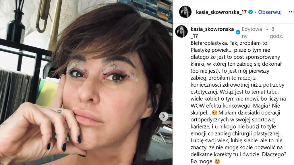 Katarzyna Skowrońska po operacji powiek