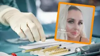26-latka wpadła w obsesję powiększania ust. Własna córka jej nie poznała