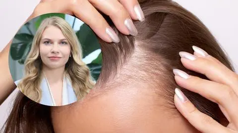 Zły demakijaż powoduje zakola u kobiet? Trycholog: "Może zaczopować mieszki"