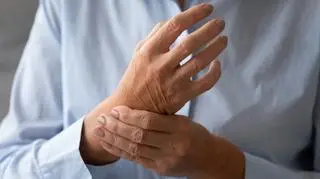 Toczeń - co to za choroba, jakie daje objawy i czy zagraża życiu?