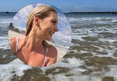 Influencerka przez przypadek wykąpała się w ściekach. "Popełniłam fatalny błąd"
