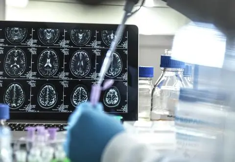 19-latek miał problemy z nauką. Lekarze zdiagnozowali u niego Alzheimera. "To najmłodszy przypadek"