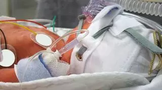 Poparzona 11-miesięczna dziewczynka jest w śpiączce