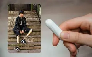 Modelka straciła obie nogi 