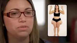 Po 8. porodzie jej uda nabrały niesymetrycznego kształtu