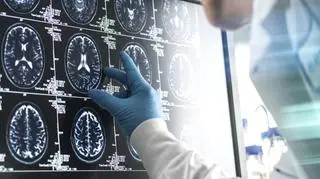 Jak wraz z wiekiem zmienia się nasz mózg? Naukowcy wyodrębnili 4 kluczowe lata