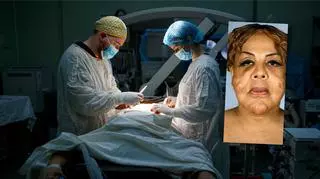 Poddała się operacji u pseudochirurga. W twarz wstrzyknięto jej klej i cement. Jak dziś wygląda?