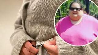 Schudła prawie 170 kg: "Zwisająca skóra sięga aż do moich kolan"