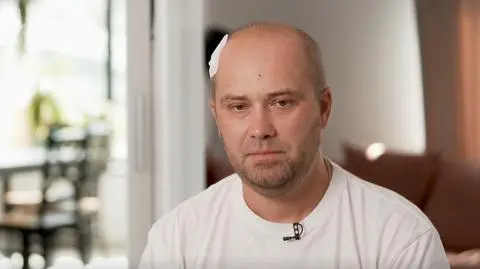 Adrian ze "Ślubu od pierwszego wejrzenia" walczy z glejakiem