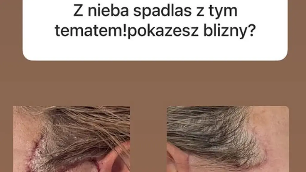 InstaStory Blanki Lipińskiej