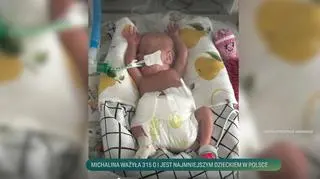 Misia, najmniejsze dziecko w Polsce, ważyła zaledwie 315 gramów. Teraz potrzebuje wsparcia