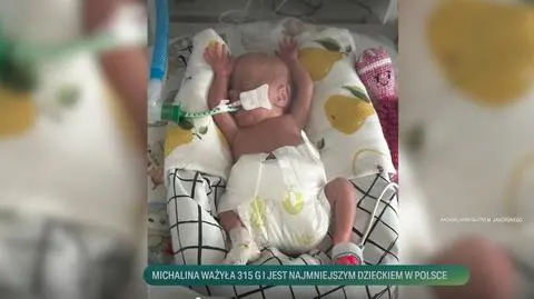 Michalina jest najmniejszym dzieckiem w Polsce 