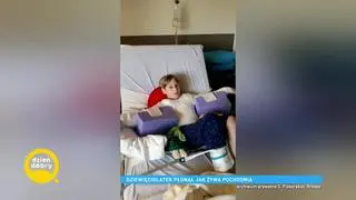 Dominik przeszedł 24 operacje