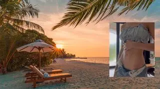 Wybrała się na wakacje na Bali. Nie przypuszczała, że dopadnie ją choroba. Czym jest "Bali Belly"?