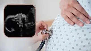 Jej córeczka żyła tylko 44 godziny. "Krzyczała tak głośno, jak tylko mogła, bo nie mogła jeść" 