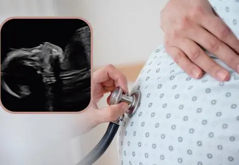 Jej córeczka żyła tylko 44 godziny. "Krzyczała tak głośno, jak tylko mogła, bo nie mogła jeść" 