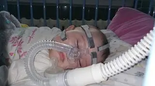 Półroczna Pola walczy o życie. "Nie była w stanie podnieść rączki, nóżki. Wodziła tylko oczami"