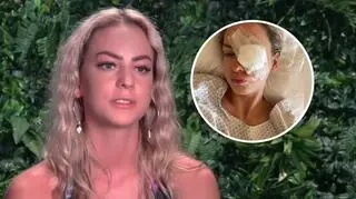 Julia z "True Love" przeszła poważną operację oka. "Przeszczep musi się przyjąć"
