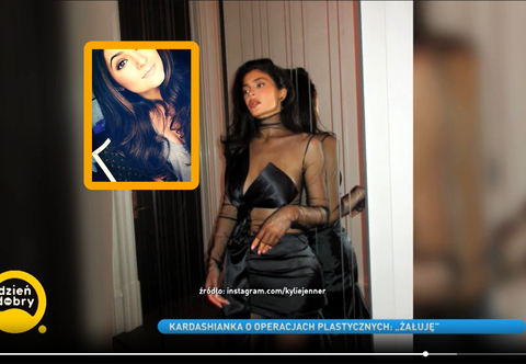 Kylie Jenner żałuje operacji plastycznych
