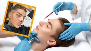 Influencer przechodzi operacje plastycze od 19. roku życia. Nie zamierza przestać, bo ciągle się sobie nie podoba