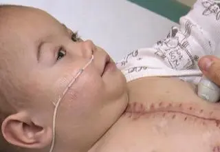 "To było życie na włosku". Jak lekarze z Katowic pomogli małemu Leosiowi?