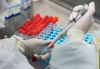 NFZ nie będzie już finansował testów na Covid-19. Pacjent musi zapłacić sam