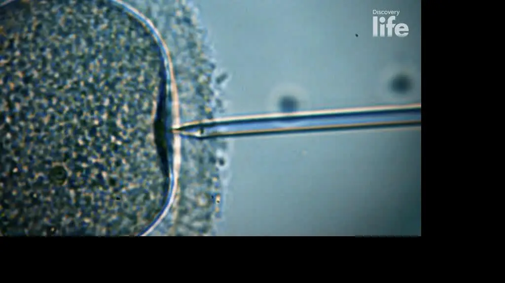 "In Vitro. Nauka czy cud?" 2 