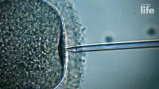 In Vitro. Nauka czy cud? Małgorzata Rozenek-Majdan o in vitro  