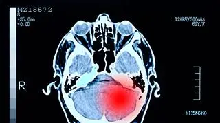 Stał się "napalony" i agresywny. Takiej diagnozy nikt się nie spodziewał