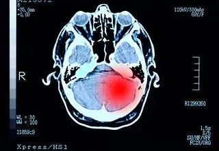 Stał się "napalony" i agresywny. Takiej diagnozy nikt się nie spodziewał