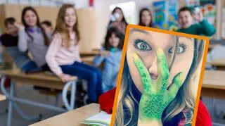 26-letnia Cassidy Laramee z Massachusetts była prześladowana za trzypalczaste dłonie