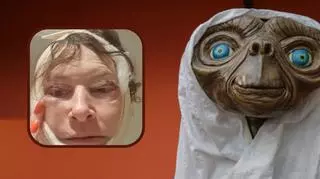 54-latka chciała się odmłodzić. Efekt operacji był szokujący. "Wyglądam teraz jak E.T." 