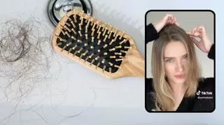 Skuteczna metoda na porost włosów? 