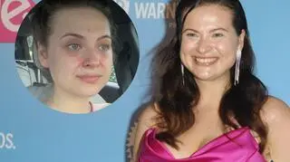 Martyna Kaczmarek pokazała twarz po popularnym zabiegu. Dziś ostrzega innych: "Uważajcie na siebie"