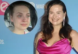 Martyna Kaczmarek pokazała twarz po popularnym zabiegu. Dziś ostrzega innych: "Uważajcie na siebie"