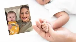Jej dziecko ma znamię na twarzy. "Czy to jest zaraźliwe?"