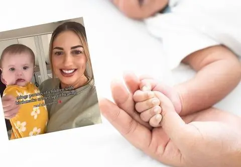 Jej dziecko ma znamię na twarzy. "Czy to jest zaraźliwe?"