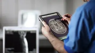 Nawet wczesne wykrycie choroby Alzheimera nie daje szans na jej zatrzymanie