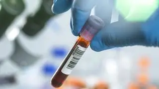 Jak wygląda badanie markerów nowotworowych? Czym są i jak często pomagają zdiagnozować chorobę?