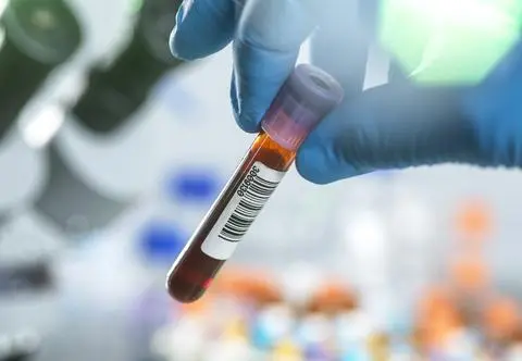 Jak wygląda badanie markerów nowotworowych? Czym są i jak często pomagają zdiagnozować chorobę?
