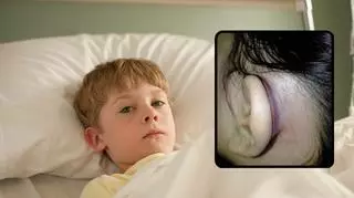 Twoje dziecko ma czerwony pasek za uchem? To może być objaw poważnej dolegliwości